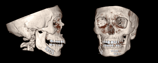 0414Figure2