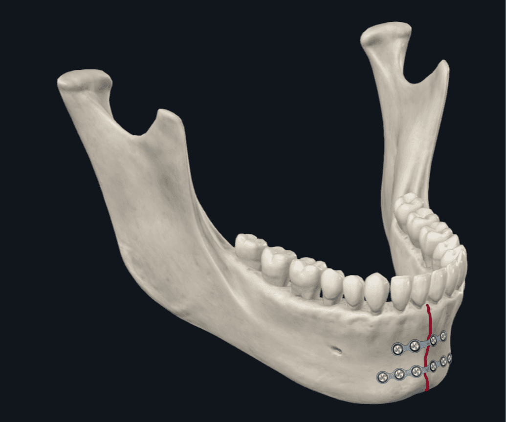 0414Figure4b